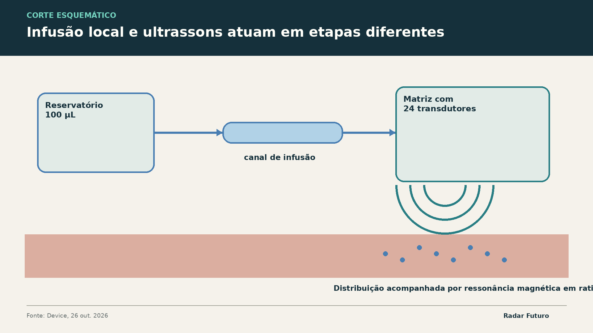 Esquema do reservatório, canal de infusão e matriz de ultrassons que auxiliam a distribuição local.